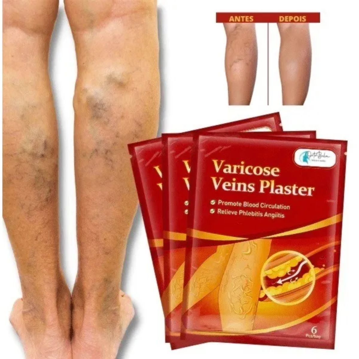 D53-KIT12ADESIVOSVARIZES